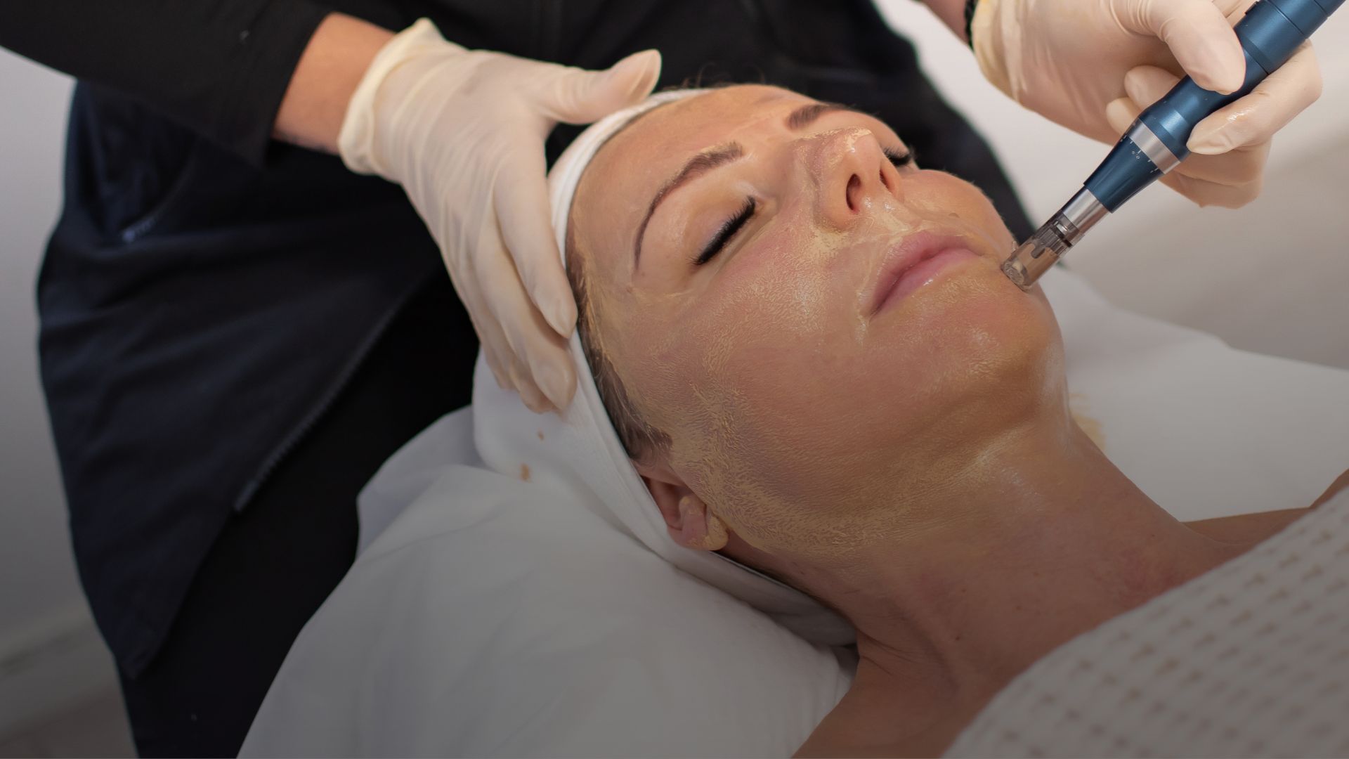 Get the Glass Skin Look with BB Glow, the Latest Korean Skin Treatment in Perth